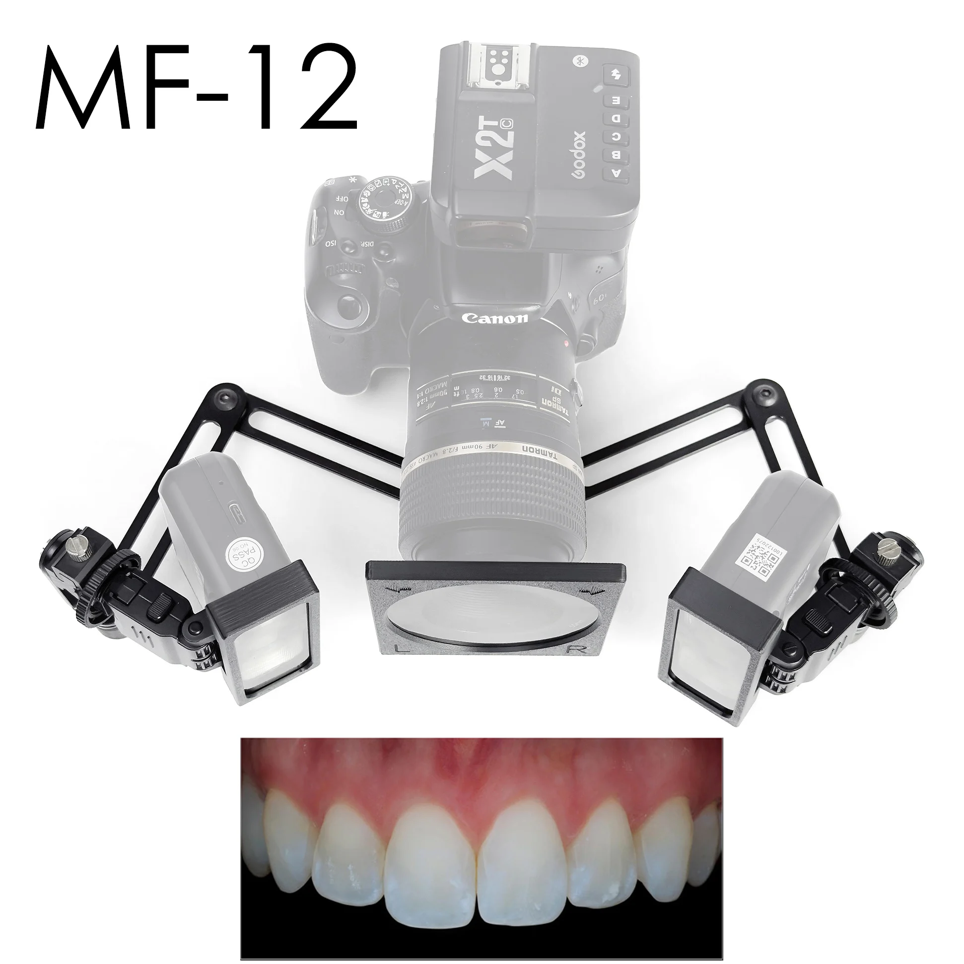 Photography Lighting Kit Godox - مجموعة فلاتر فلاش جودوكس MF12 للكاميرات.